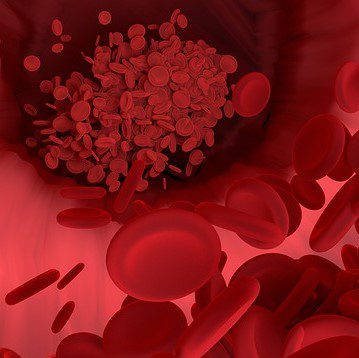 Experimental Therapy for Hemophilia Meets Phase 3 Trial Endpoints