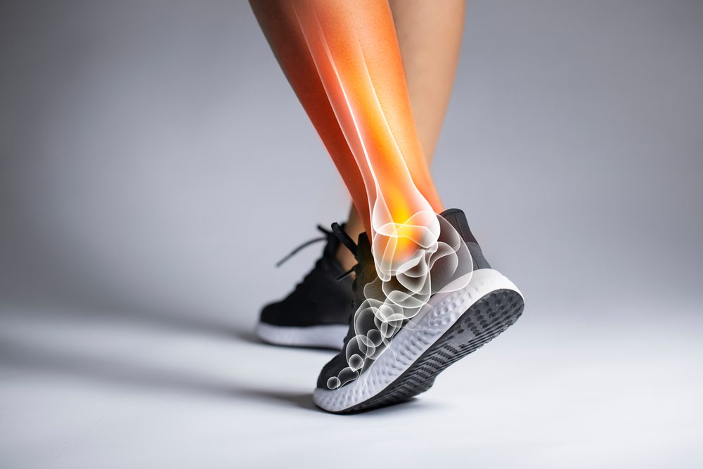 Study: X-Linked Hypophosphatemia Has Detrimental Impact on the Ankles