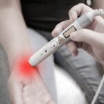BTK Inhibitor Brings Rapid Improvement in Chronic Spontaneous Urticaria