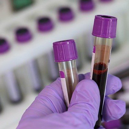 The FDA Has Approved the First Blood Test to Identify Multiple Hereditary Cancers