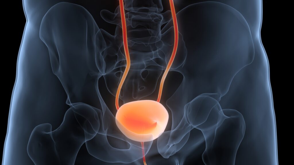 Study: Pelvic Floor Muscle Training is no Better Than Bladder Training for Overactive Bladder