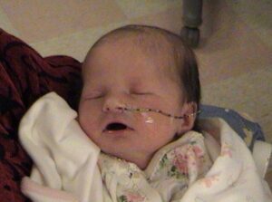 Justice, who has PWS, as a baby in the hospital.
