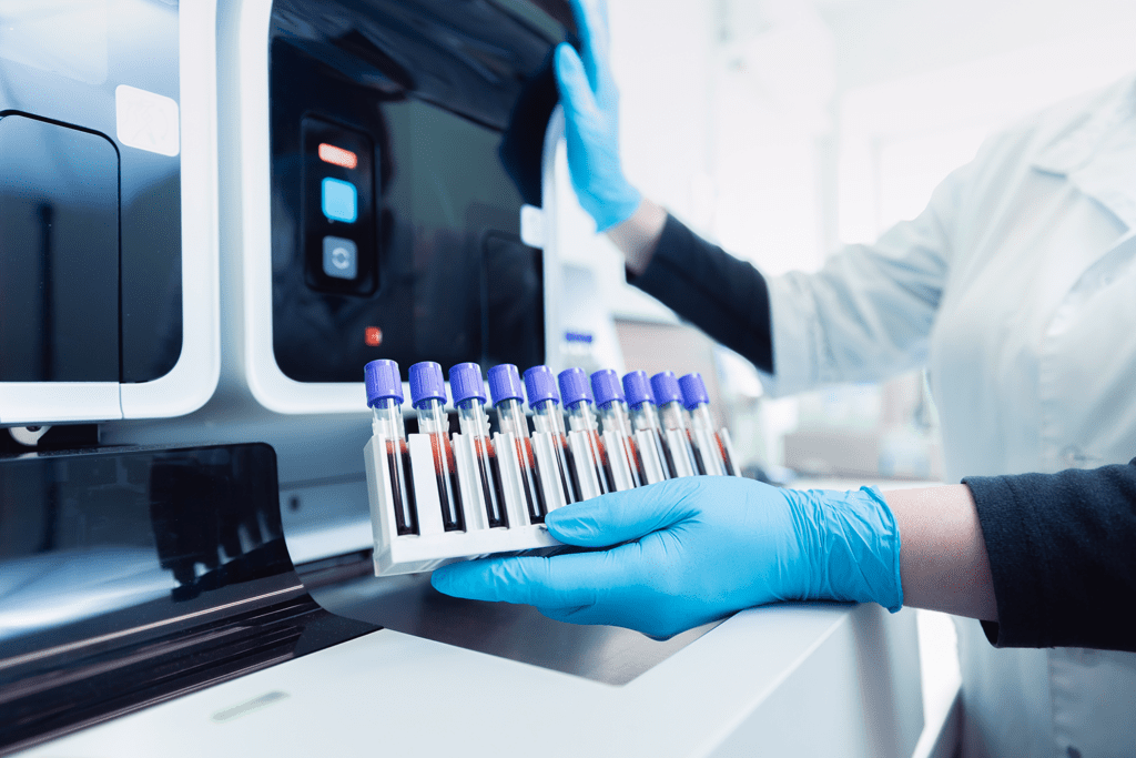 A New Blood Test Could Identify FTD, ALS, and PSP