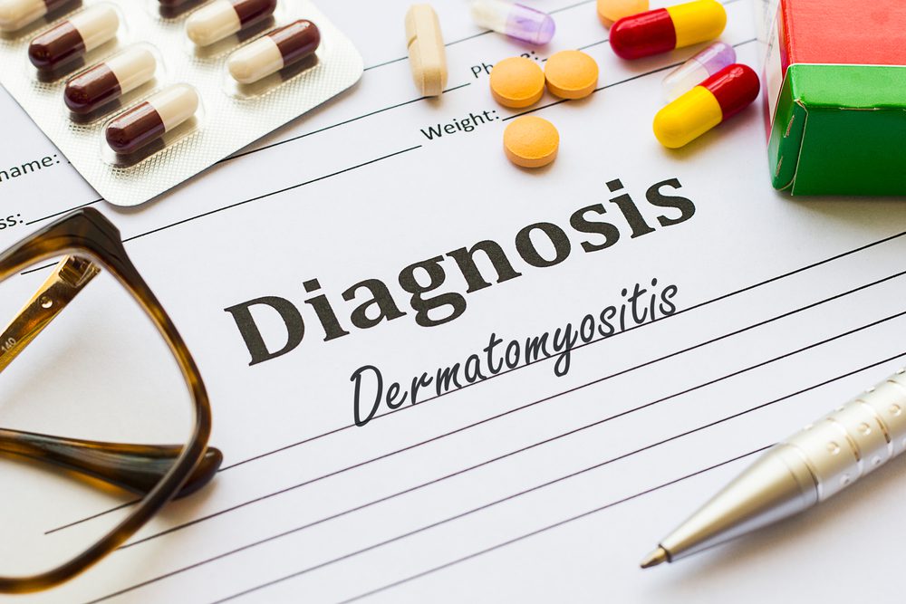 Report Highlights Deficiencies in Dermatomyositis Care