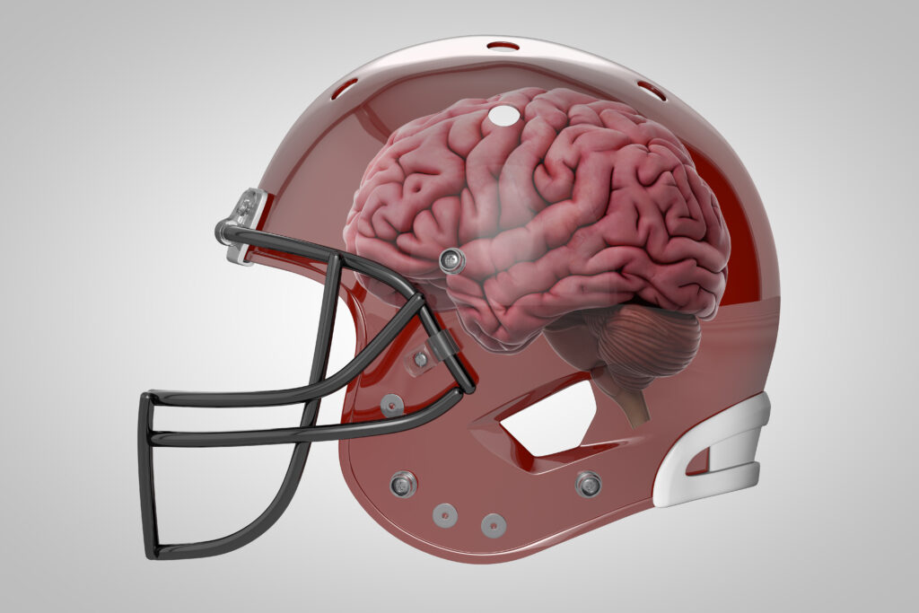 Study shows sports-related brain injuries linked to long-term neurodegenerative diseases