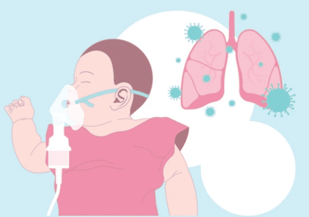 After a Nationwide Outbreak of EV-D68 in 2014, the CDC Suggests Caution When Treating Children for Respiratory Disease
