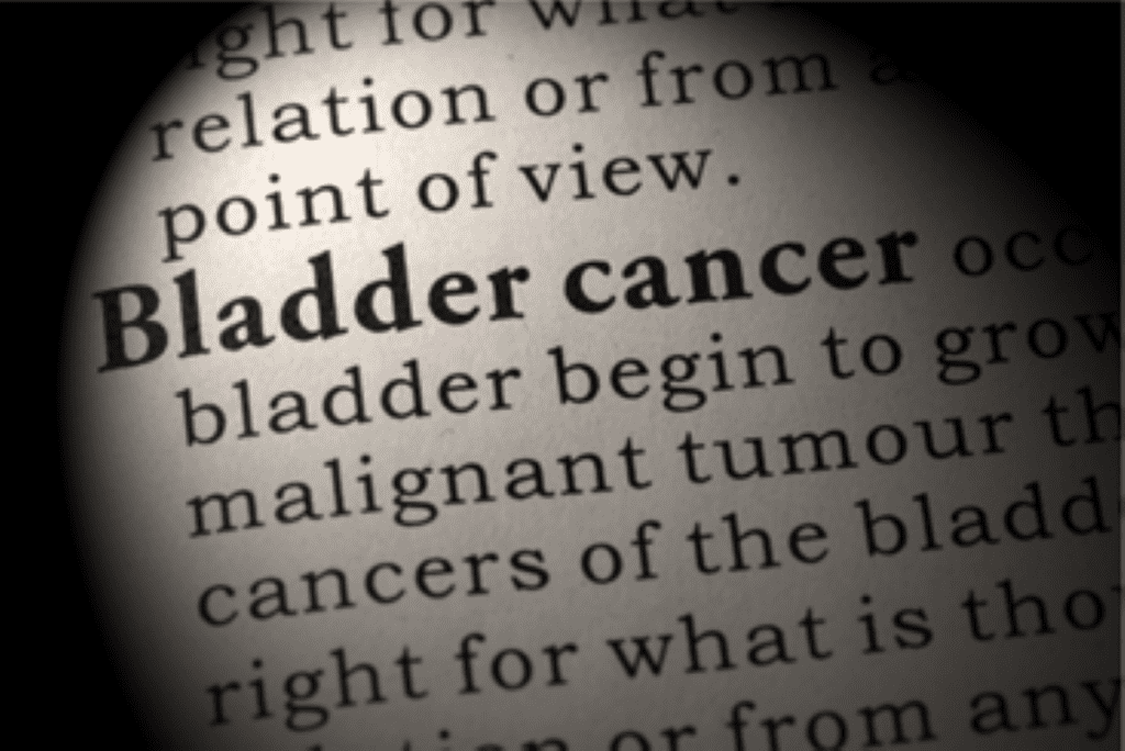 An Overview on Bladder Cancer
