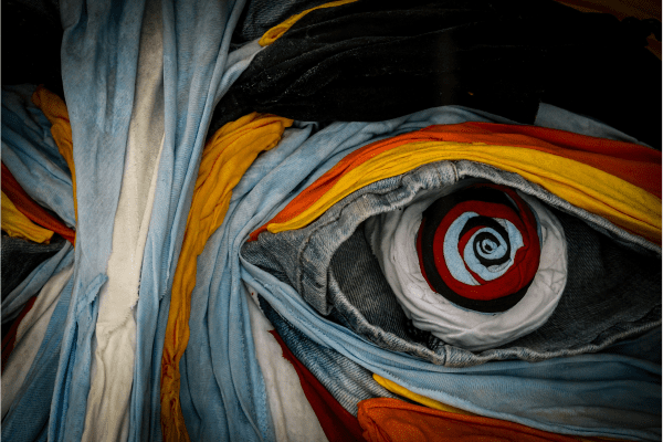 Understanding Myasthenia Gravis: Insights from the TREND Community