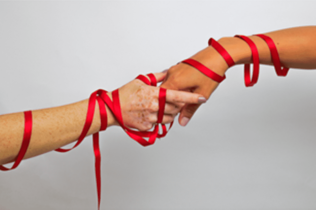 Facelift Surgery Emerges as a Promising Solution for HIV-Associated Facial Lipodystrophy