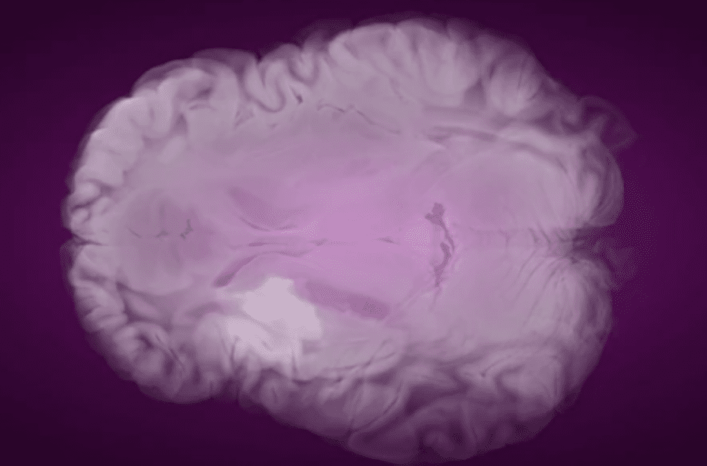 Blood-Brain Barrier Part 1