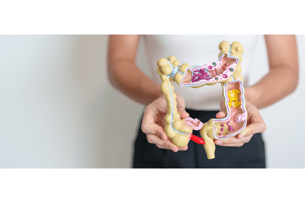 “Three Things I Tell Newly Diagnosed Ulcerative Colitis Patients” by Laura Scaviola