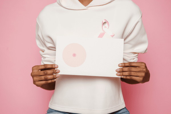 Giredestrant Emerges as Breakthrough Adjuvant Therapy for Early-Stage ER-Positive Breast Cancer