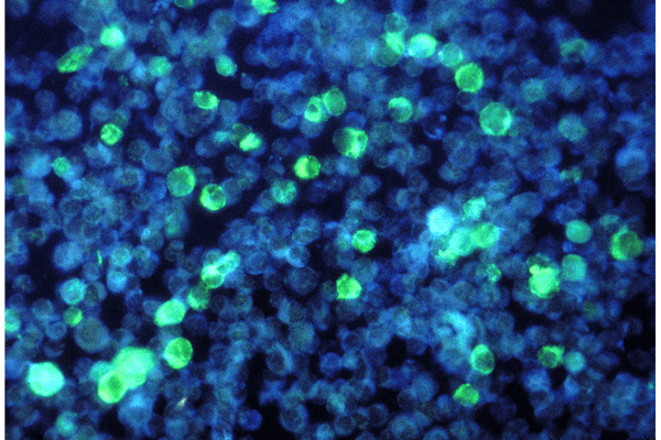 RFK’s Granddaughter, Tatiana Schlossberg, Reveals Diagnosis of Rare Blood Cancer