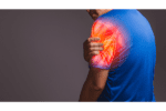 Phase 3 VALOR Trial Shows Brepocitinib Improves Outcomes in Dermatomyositis