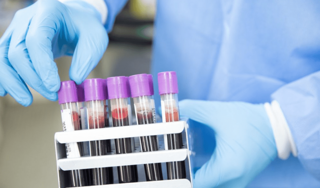 ModeX Advances Novel Tetraspecific Antibody Into First-in-Human Study for B‑Cell Lymphoma