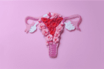 Labcorp Brings Breakthrough Diagnostic to Identify Platinum-Resistant Ovarian Cancer Patients