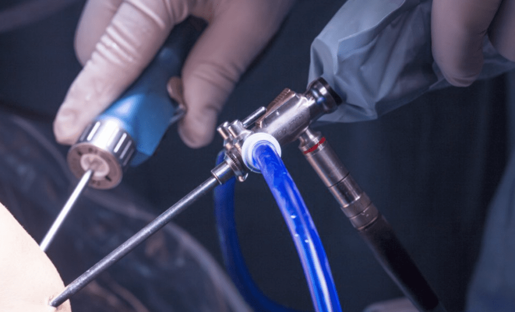 Topical Curcumin Gel Shows Promise for Knee Osteoarthritis Pain in Early Clinical Trial