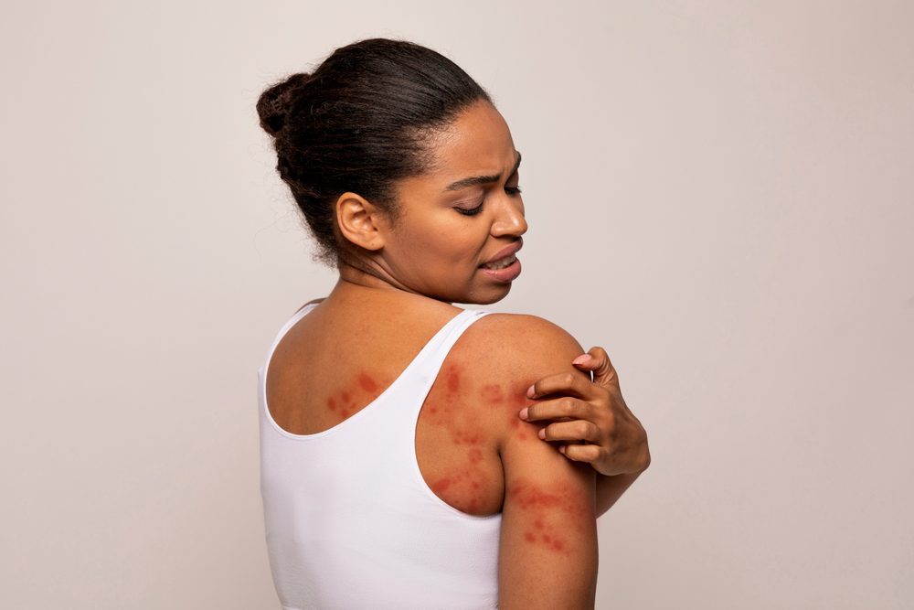 Epidermolysis Bullosa Care Enters a New Era With Gene-Targeted and Wound-Healing Therapies