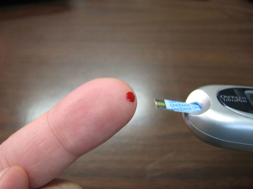 FDA Grants Accelerated Approval to Teplizumab for Newly Diagnosed Pediatric Type 1 Diabetes