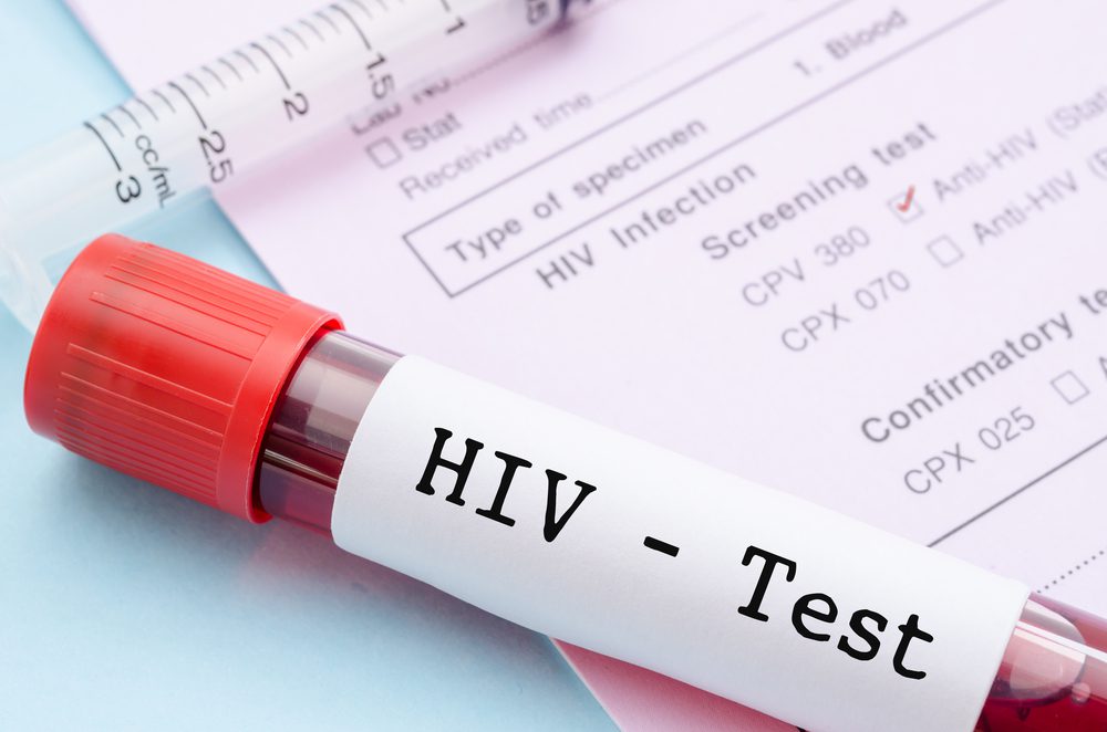Novel HIV Vaccine Generates Strong Broadly Neutralizing Antibody Responses in Preclinical Study
