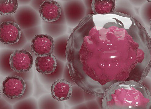 FDA Clears Orca Bio’s Tregzi for Adults Undergoing Allogeneic Stem Cell Transplantation for Blood Cancers