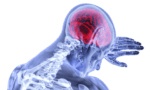 Advances in Stroke Recovery