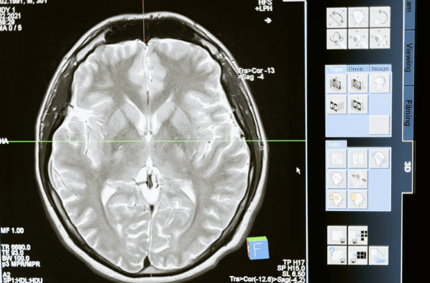New Consensus Recommendations Aim to Strengthen Communication and Decision-Making in Neuroblastoma Care