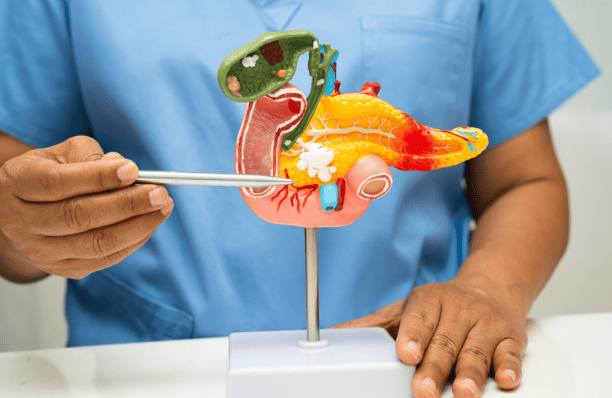 A Breakthrough 50 Years in the Making: FDA Approves First Drug to Directly Target Pancreatic Cancer’s Primary Driver