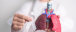 Investigational Immunotherapy Improved Survival in Advanced Squamous NSCLC