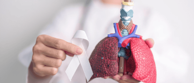Investigational Immunotherapy Improved Survival in Advanced Squamous NSCLC