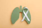 Rare Inherited EGFR Mutation Greatly Raises Lung Cancer Risk