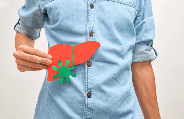 Primary Biliary Cholangitis: The Diagnosis That Arrives Years Too Late
