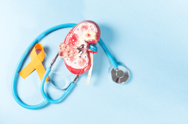 FDA Approves Belzutifan Plus Lenvatinib for Previously Treated Advanced Clear Cell Renal Cell Carcinoma