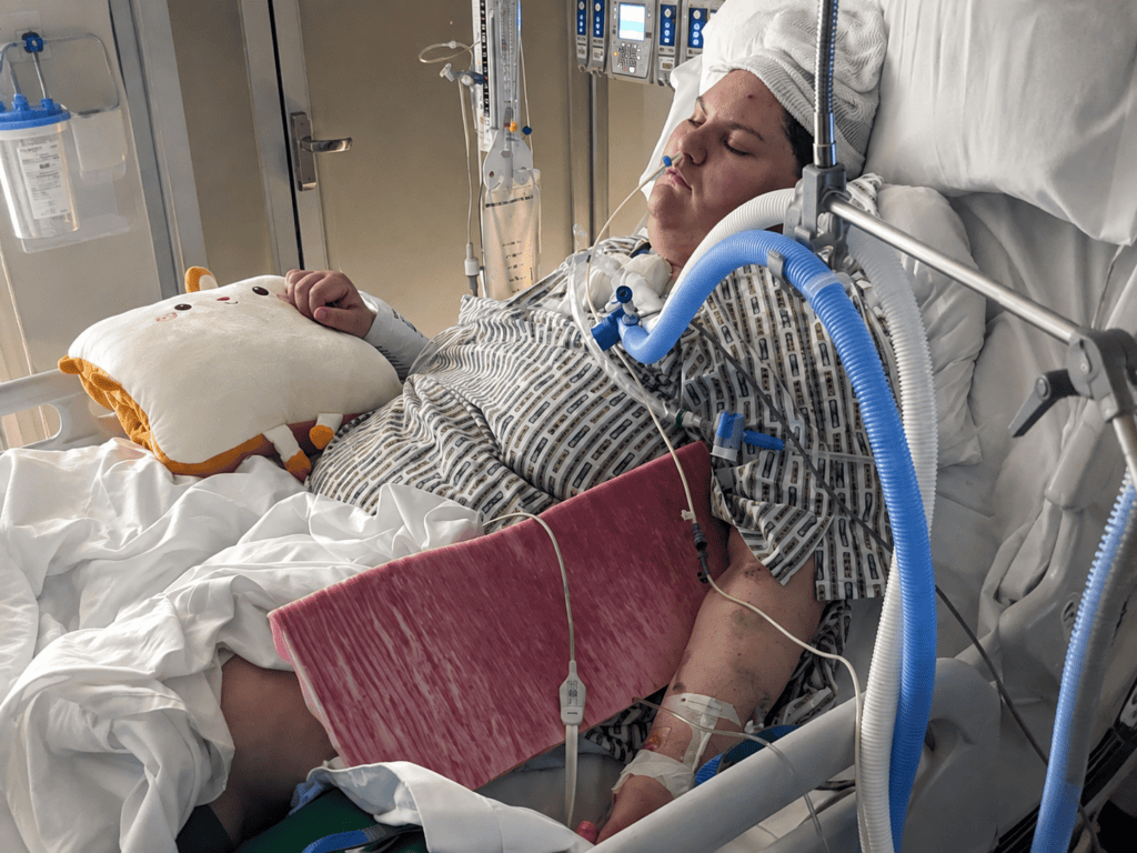 Vanessa’s Acoustic Neuroma Story